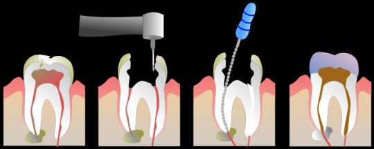 Endodontia - Oral Arte Odontologia